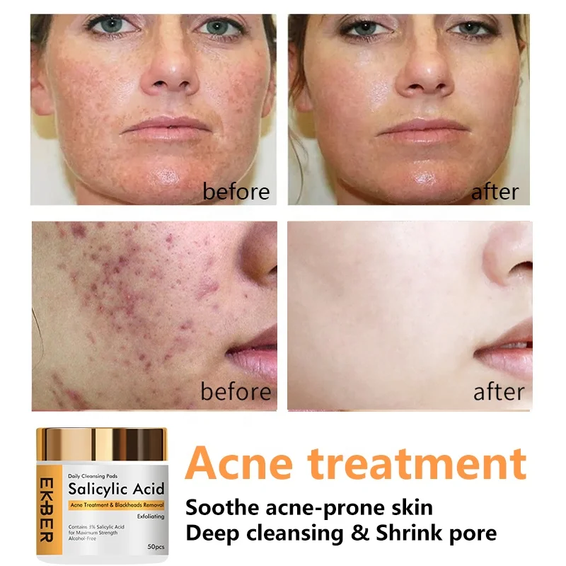 Salicylic Acid Pads Natural Skincare Brightening Whitening Shrink Serum Remove Black Head Treatment Face Patch Anti Acne