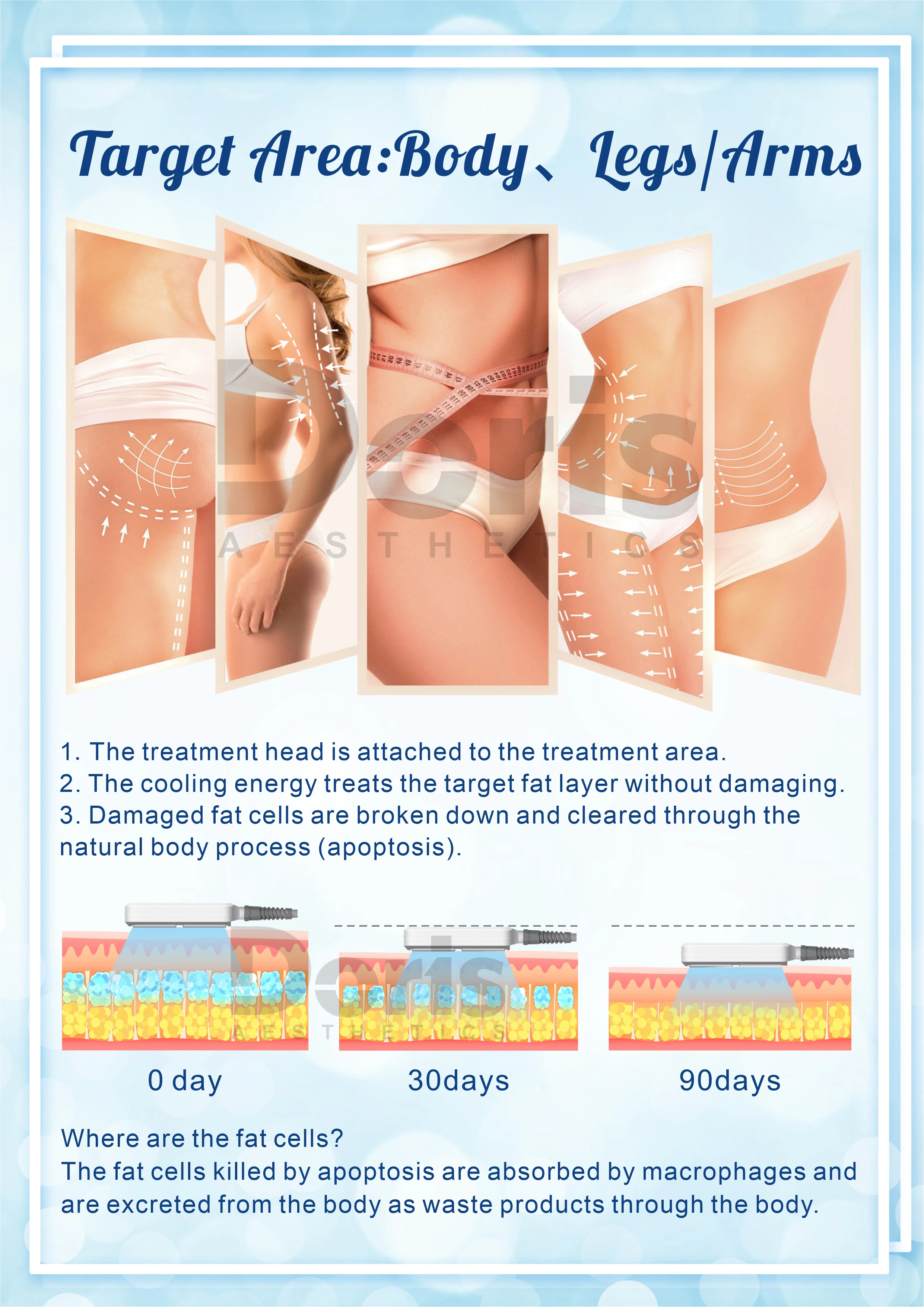 RF Lipolysis 360 Degree Frozen Body Cryo Therapy Cooling Cellulite Reduction Coolsculption Slimming Machine