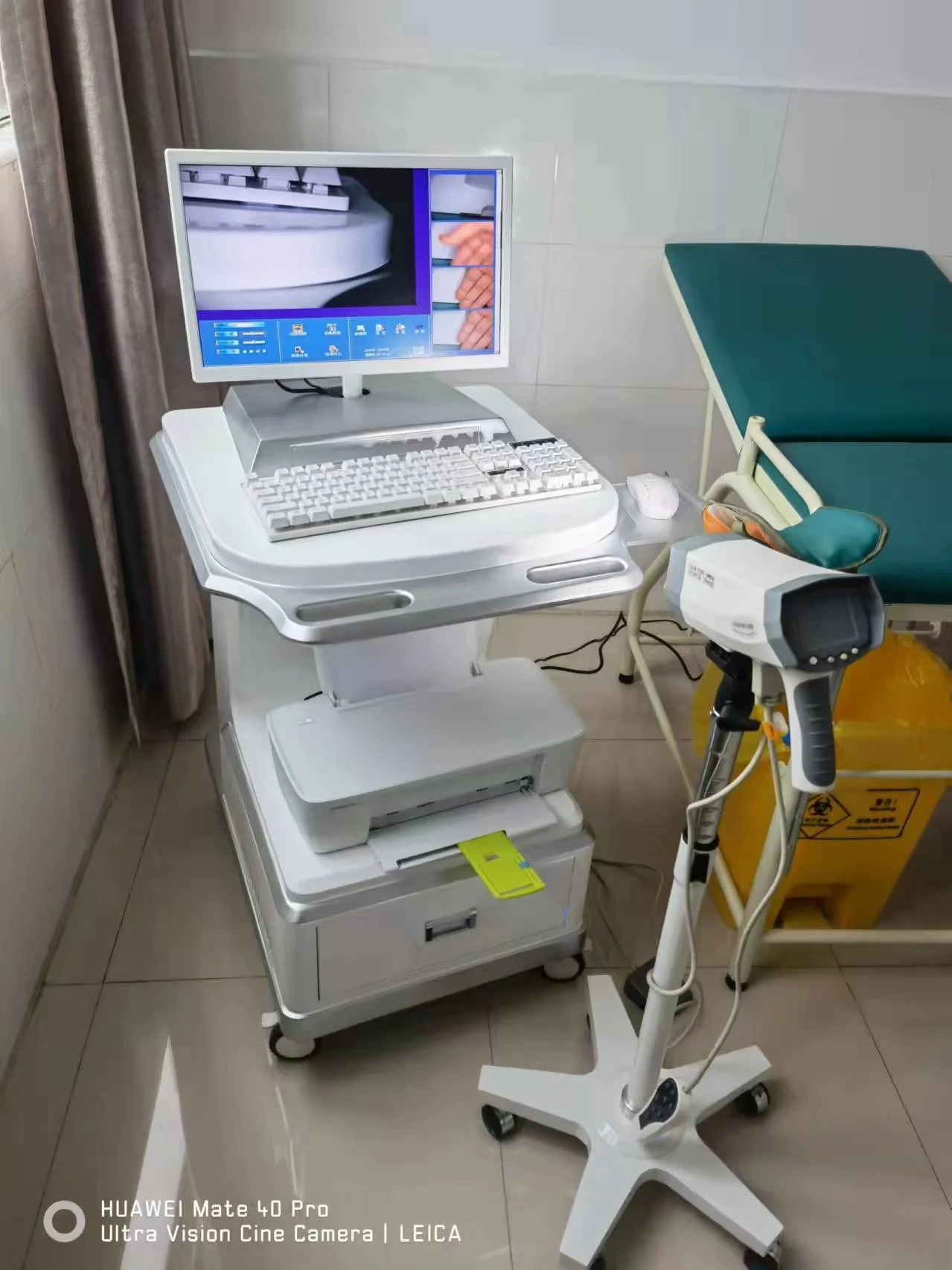 YD-220 High Quality Digital Video Vagina Colposcope Portable Colposcopy Gynecology Examination Equipment