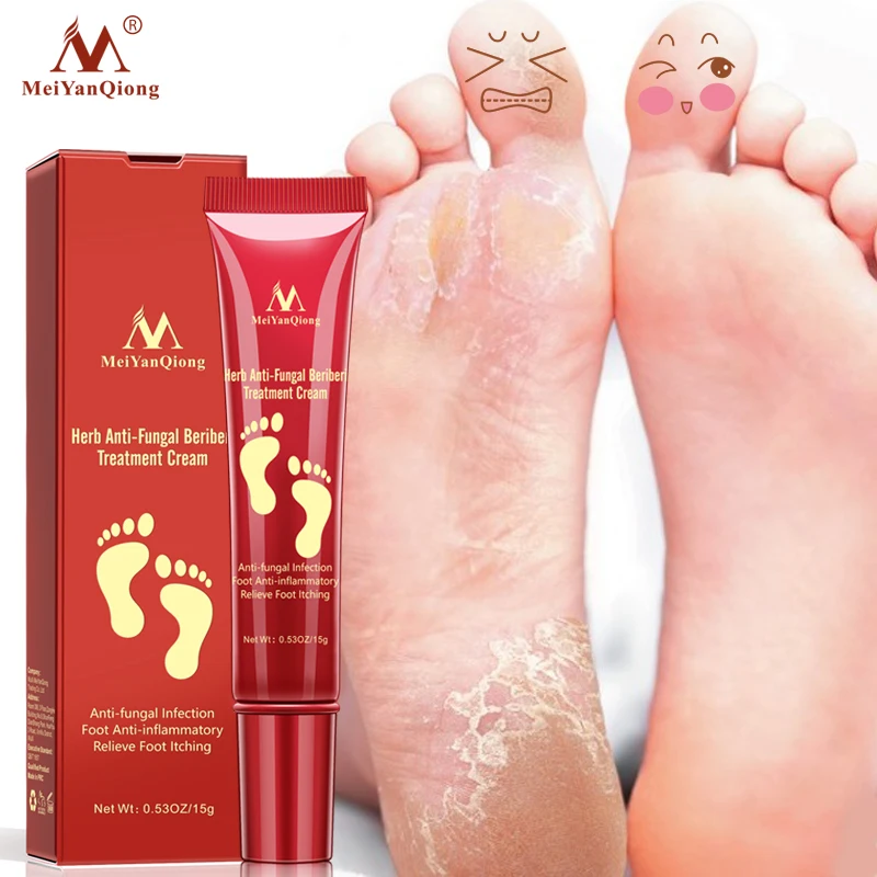
Foot treatment for dry cracked feet to remove fungus 