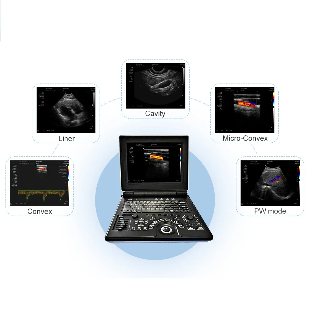 Handheld Veterinary Ultrasound Machine 12 inch Low Price Portable Animal Cow Cattle Vets Ultrasound Scanner