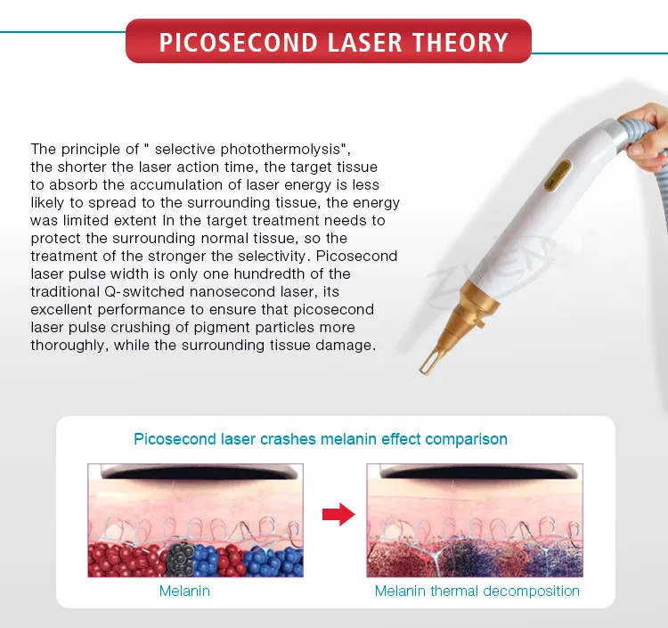 Niansheng factory picosure picosecond q switched nd yag laser tattoo removal machine for carbon peeling freckle removal