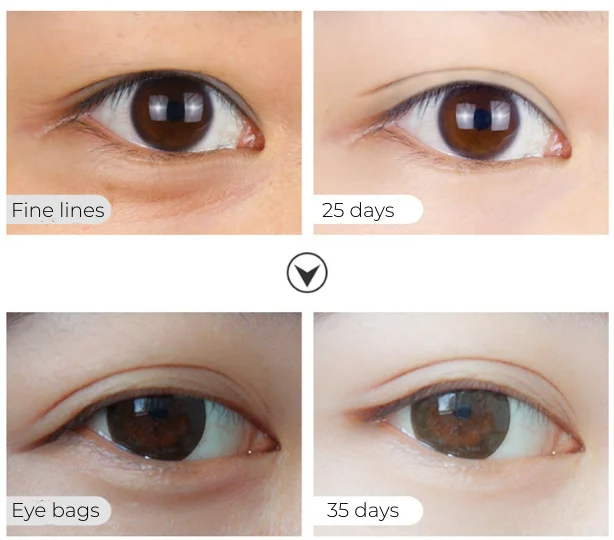 Instant Eye Cream Fine Lines Eye Bags Instant Removal Eye Cream