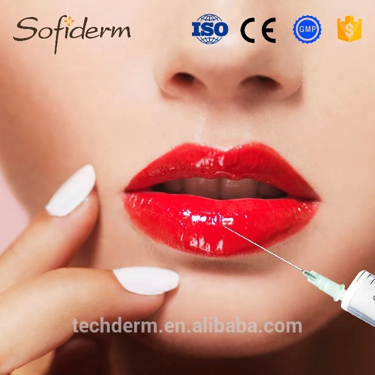 Sofiderm cross linked hyaluronic acid gel filler for lips enhancement