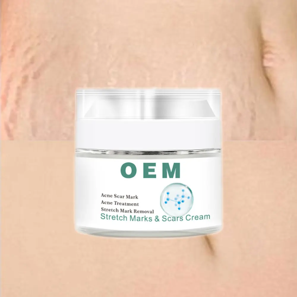 Anti Wrinkle Anti Aging Moisturizing Collagen Snail Extract Eye Cream Whitening Repairing Snail Face Cream For Repair Acne Scar