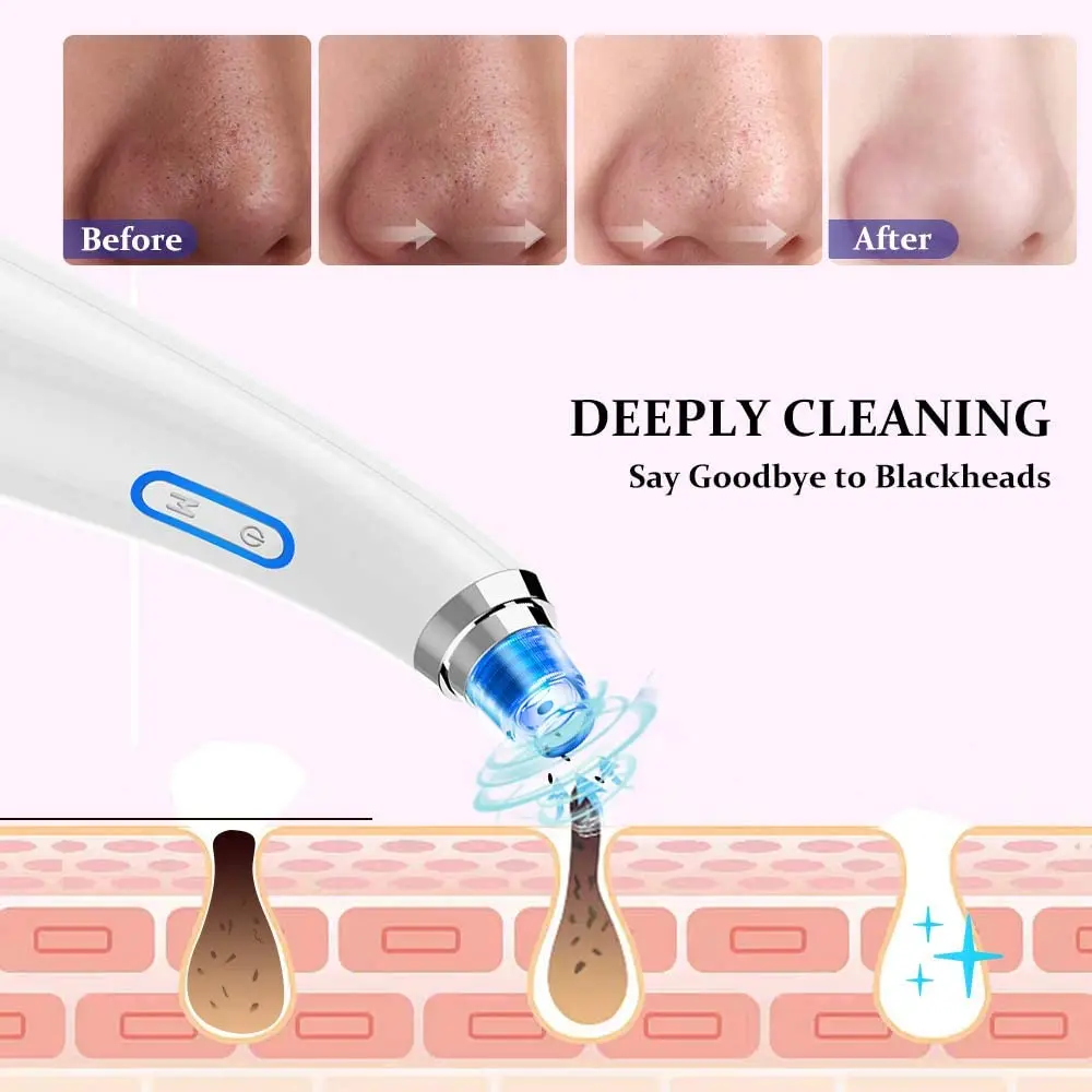 Trending Product 2023 New Arrival Electric Blackhead Remover Facial Cleaner Vacuum Blackhead Remover with light therapy