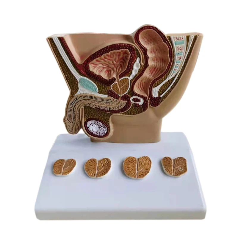 PVC human male pelvis Anatomical with prostate pathology  section medical science