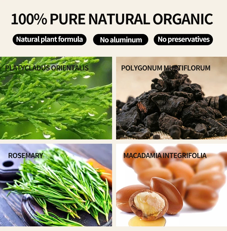 private label natural organic onion hair oil serum men women ginger biotin rosemary hair growth for regrowth care