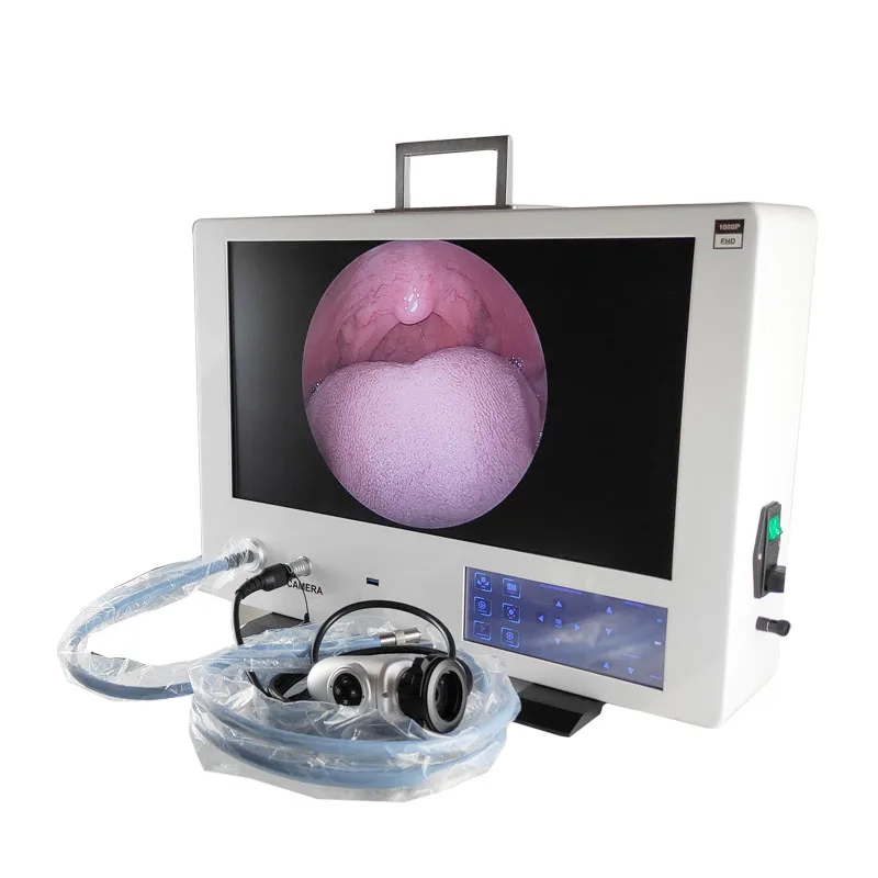 telepack all in one Portable Medical Endoscopic camera system  full HD rigid Endoscope Camera  with recording