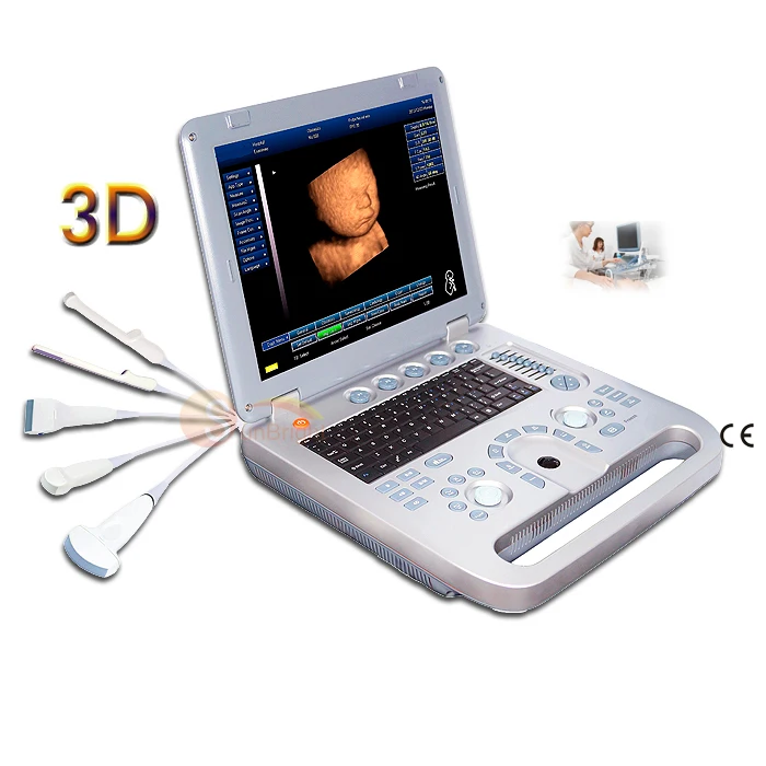 SUN-800D Hand Carried Portable Ecografo B/W Ultrasound Machine Scanner