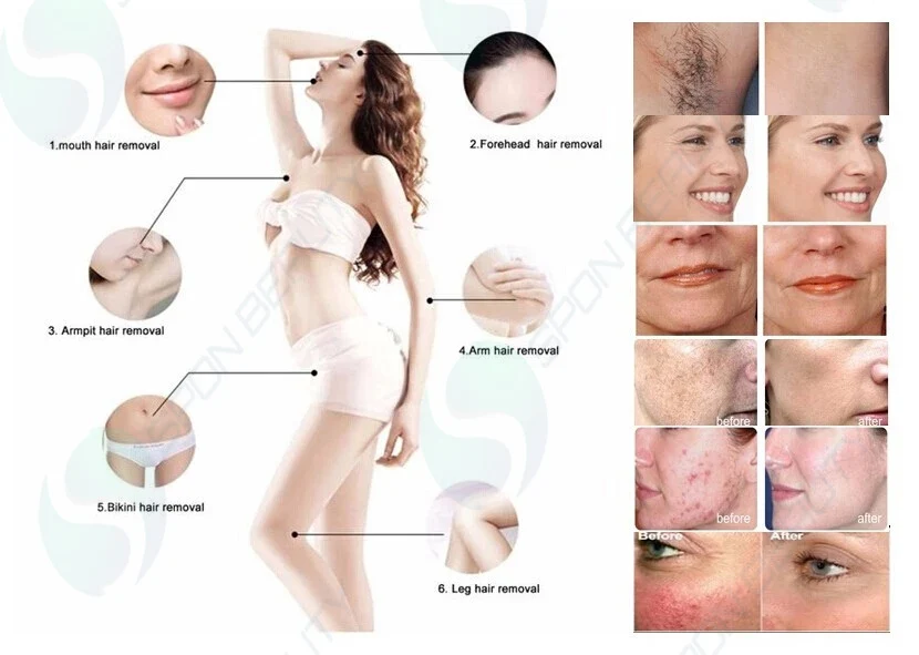 2021 newest technology 4 in 1 Fast Hair Removal 360 Magneto hair remover machine OPT/IPL laser hair removal