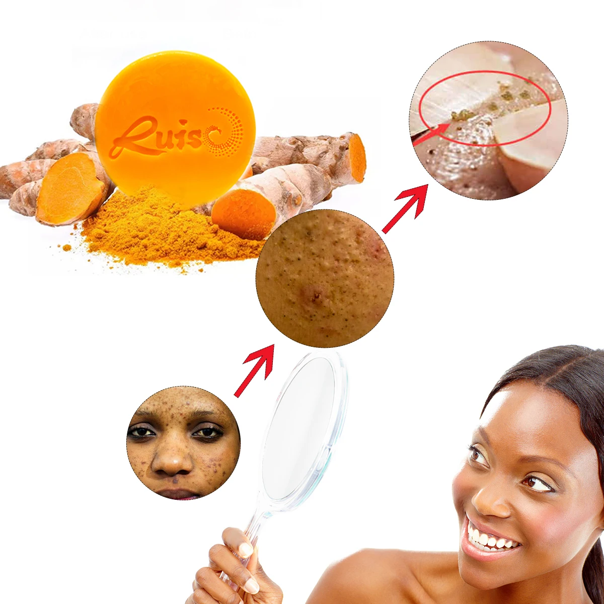 Hot sale products Wholesale Organic Raw Face Anti-acne Whitening Body Wash Tumeric Ginger Handmade Soap