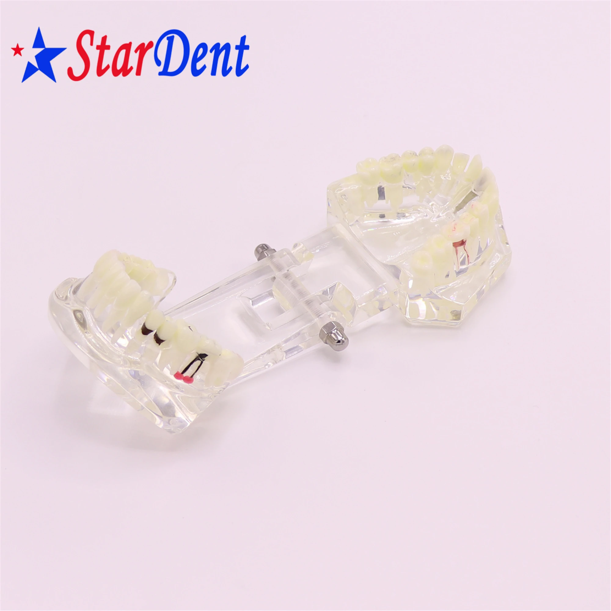 Dental  Teeth Implant Model For Tooth Implant Practicing