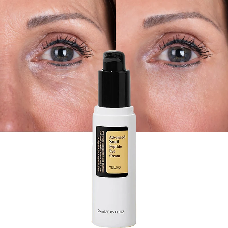 Private Label Dark Circles Remove Peptide Eye Cream Rapid Anti Wrinkle Anti Aging Eye Cream Snail Peptide Eye Bags Removal Cream