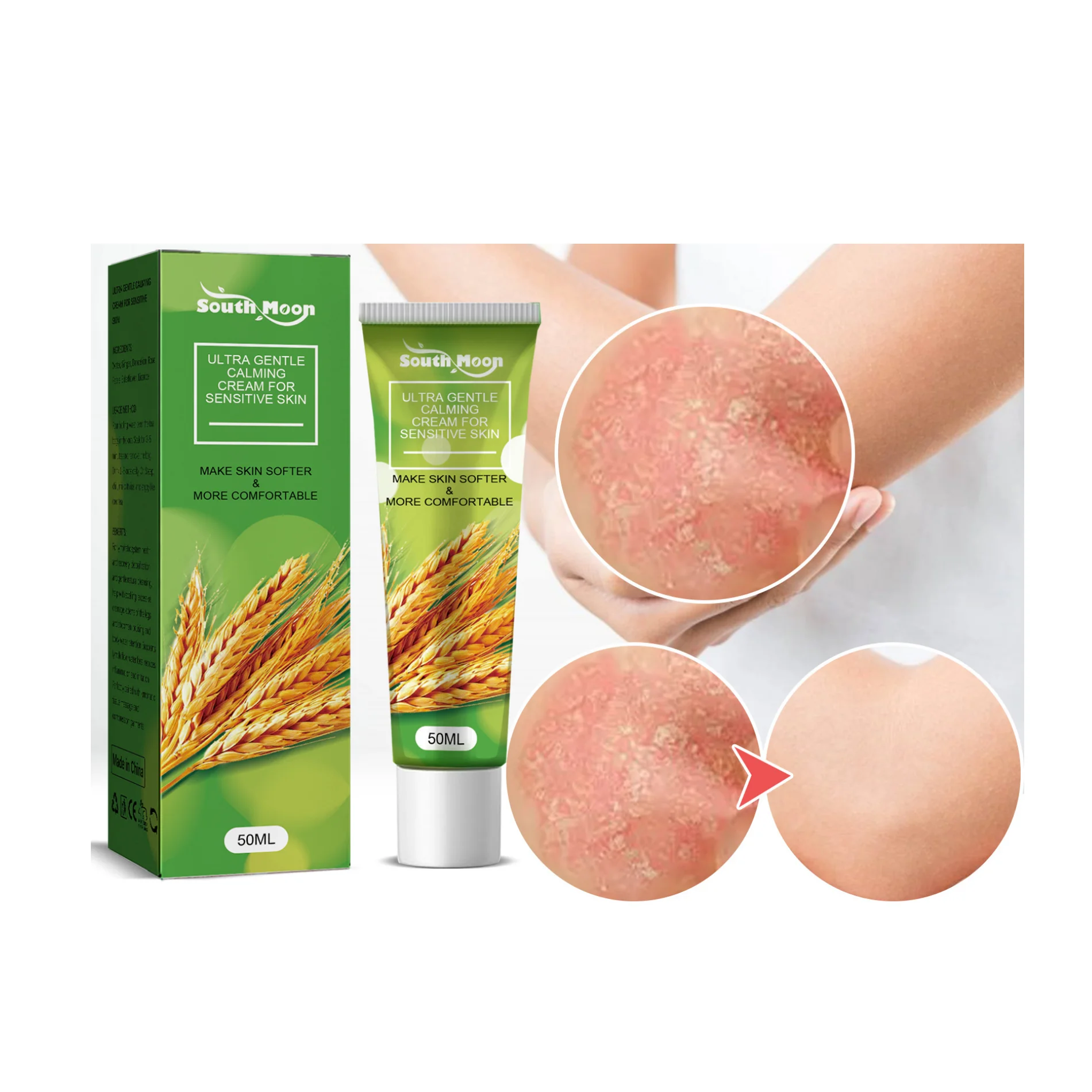 Herbal Cream Psoriasis Cream Anti-itch Relief Eczema Skin Rash Urticaria Desquamation Treatment