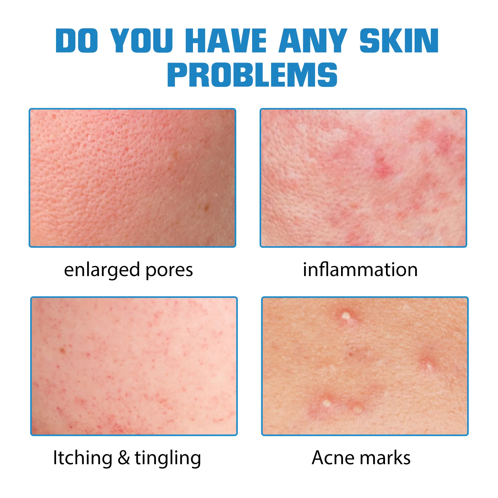 EELHOE Hyaluronic acid essence Moisture replenishment repair and fade facial acne marks skin care whitening essence