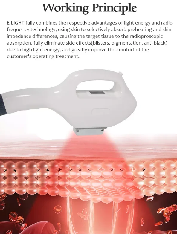 working principle.png