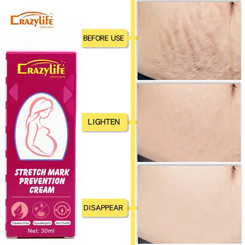 crazylife body cream Belly nourishing cream for pregnant women Stretch marks removed cream