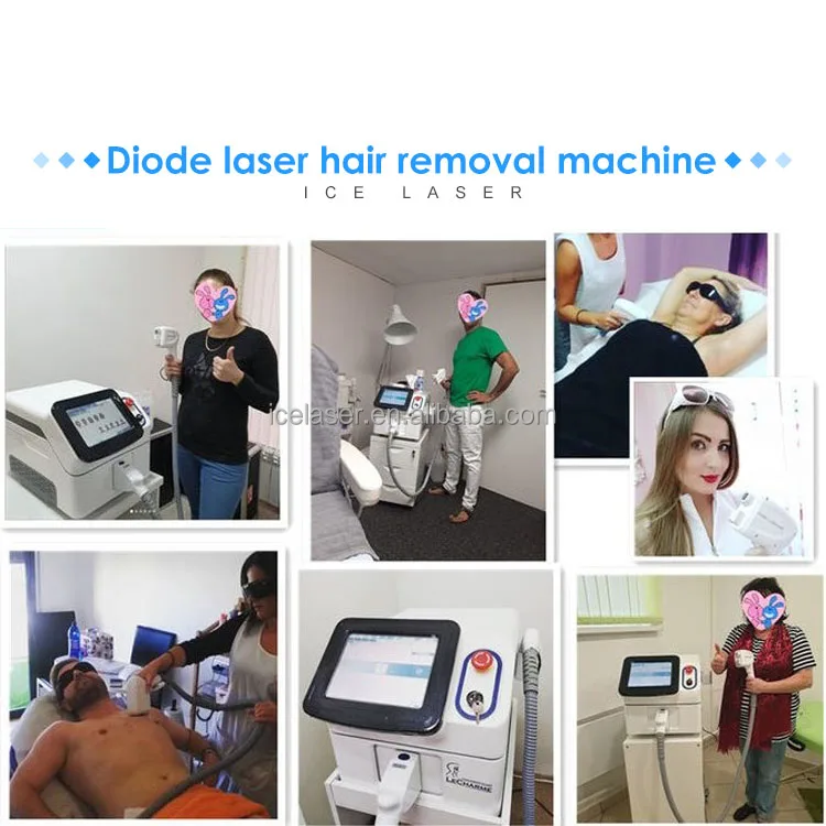 hair removal machine