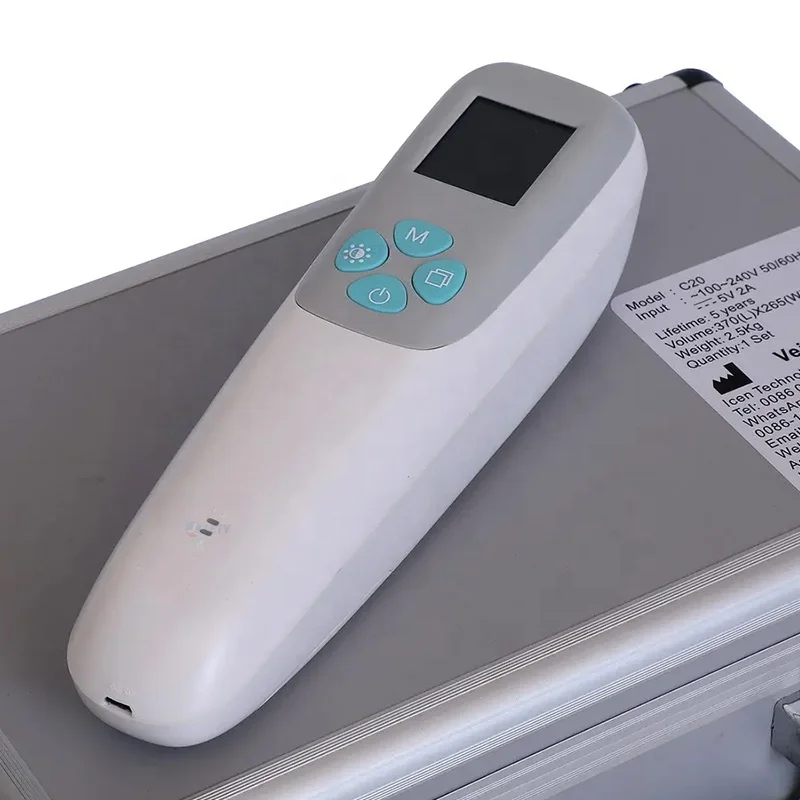 Factory Price Portable Medical Infrared Vein Viewer Finder Machine For Finger Vascular Blood Detector Vascular Imager