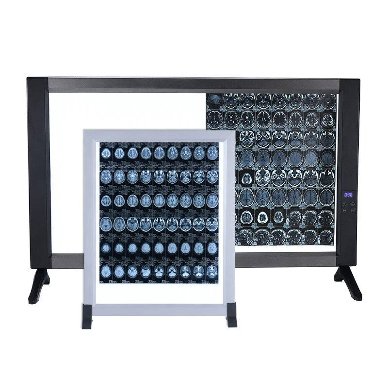 Single/double/triple Panel Medical X-ray Film View Box Ultrathin Led Box Illuminator Negatoscope