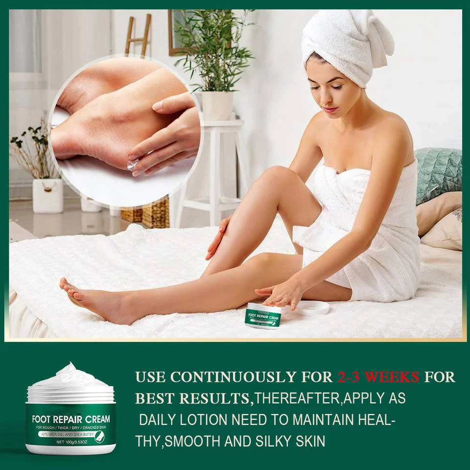 Anti Fungal Foot Repair Foot Cream Dead Skin Removal Peeling Moisturizing Exfoliation Foot Care Repair Cream For Cracked Heels