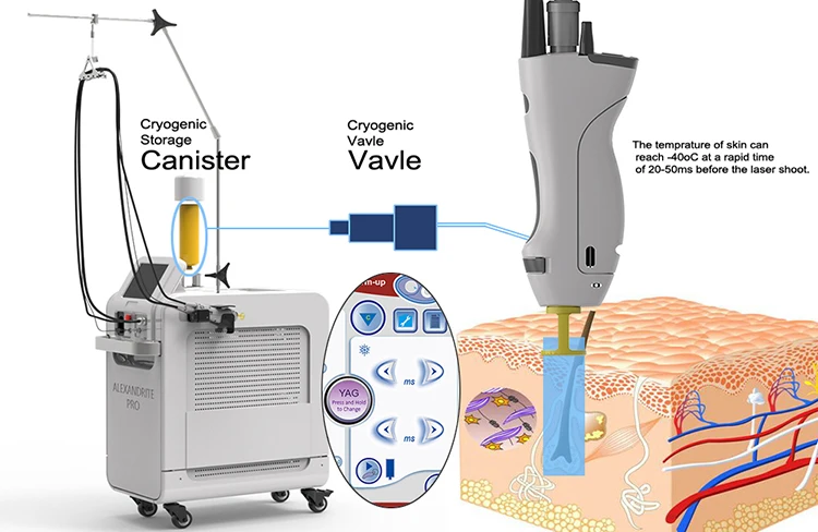 Factory price alexandrite Laser 755nm Depilator hair removal machine