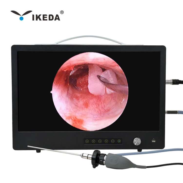 YKD-9122 портативный эндоскопическая/эндоскоп HD камера для