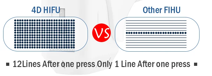 4D hifu and other hifu.png