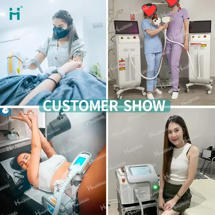 2 in 1 diode and picosecond laser picosecond q-switched laser tattoo removal machine diode laser hair remowal with picosecond