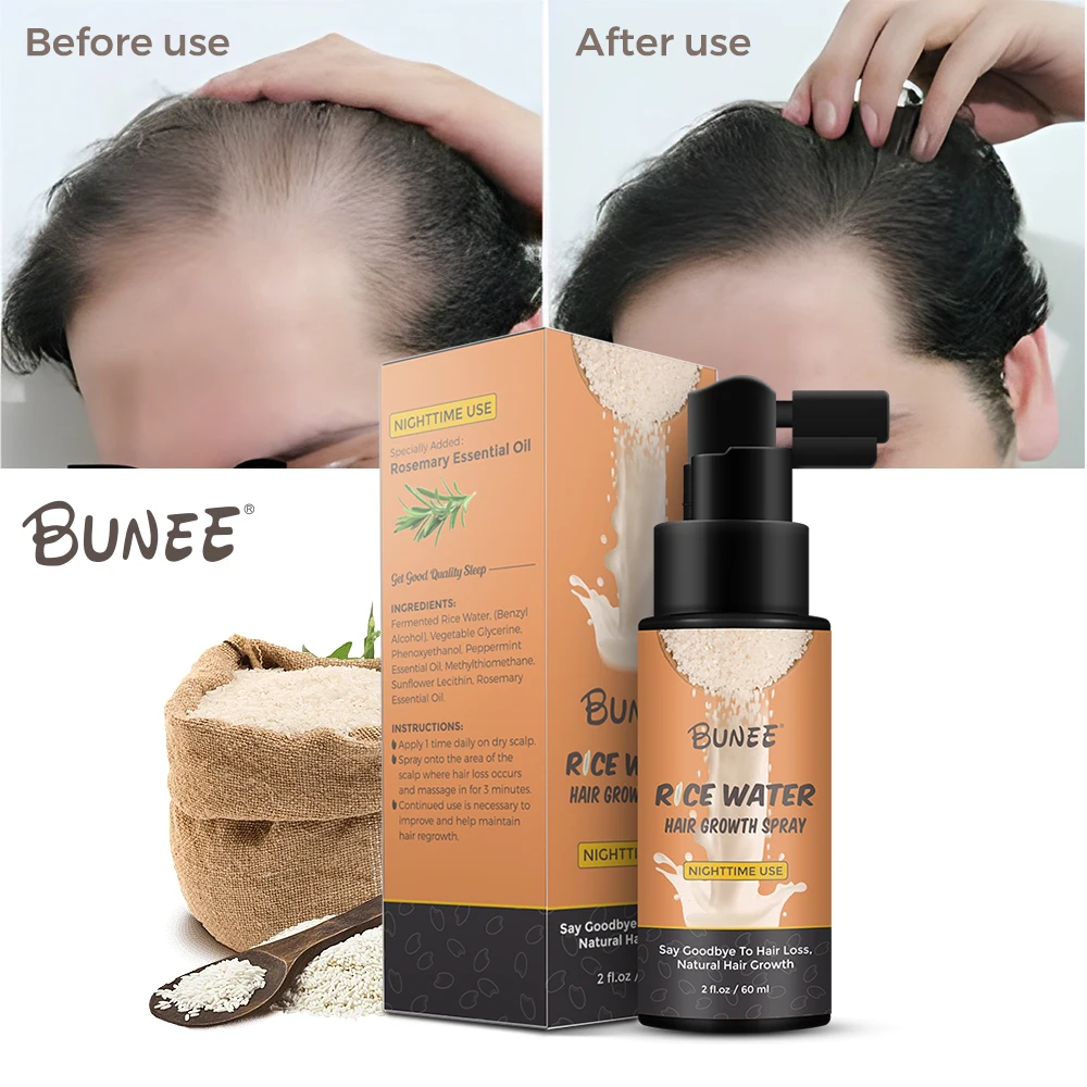 Rice Water Hair Spray Rice Water Hair Growth Spray with Rosemary Oil for Hair Loss Treatments for Women and Men