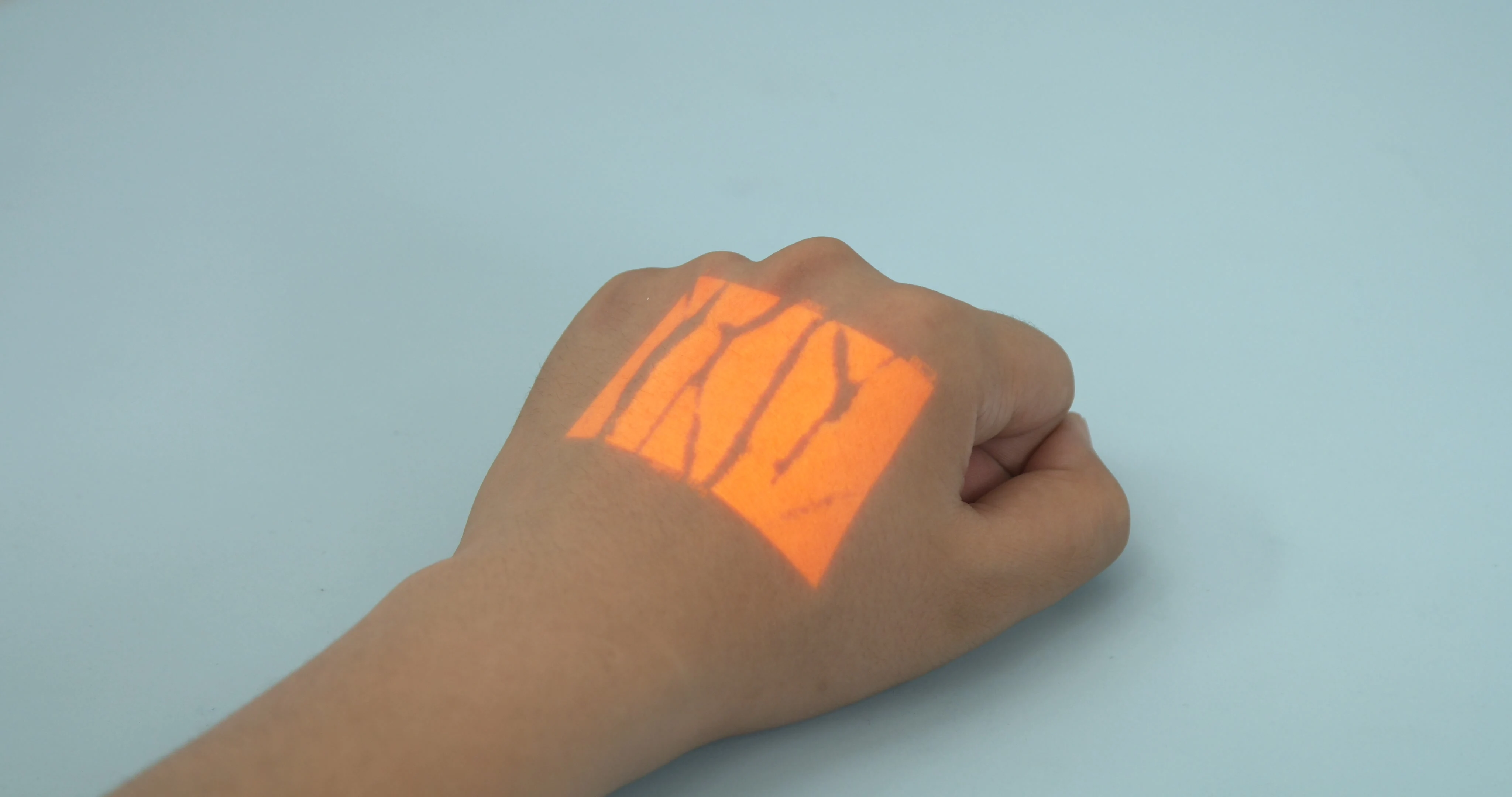 RC-VF500T  rechargeable transilluminator vein finder lamp made in china