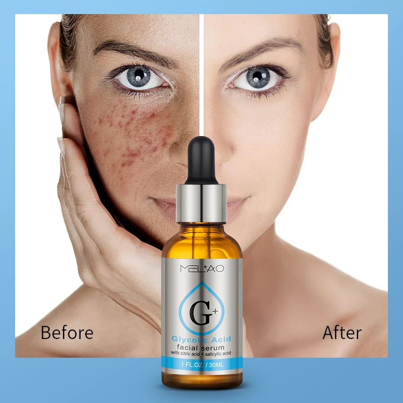 Wholesale Hot selling Private Label Natural organic Anti-aging Smooth Wrinkles Anti Acne Treatment Collagen Glycolic Acid serum