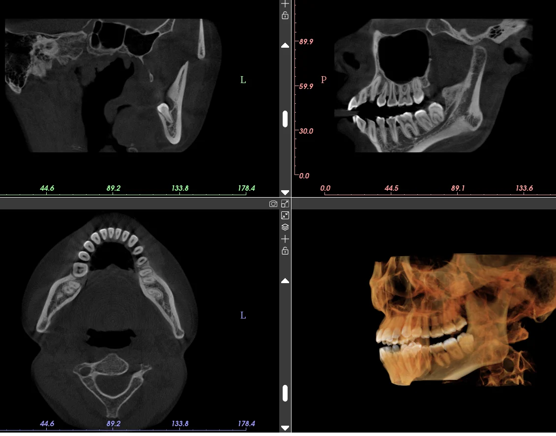 3D Medical Equipment Multifunctional CbCT X-ray Dental