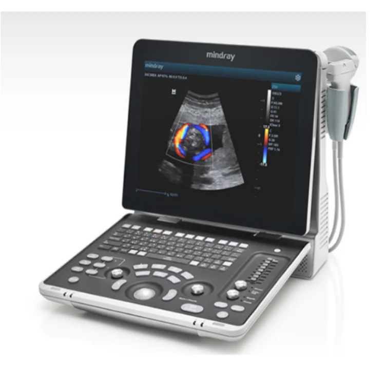 Hot sales Mindray Z50BW color doppler ultrasound diagnosis ultrasound for hospital clinic