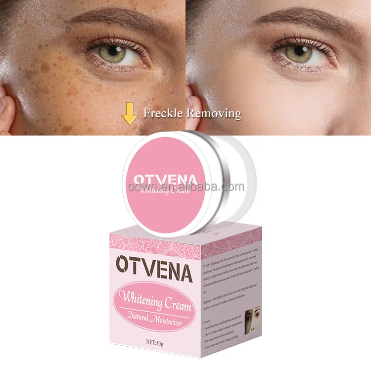 Hot Selling 100% Effective Moisturize Skin Dark Spots Freckle Removal Whitening Cream