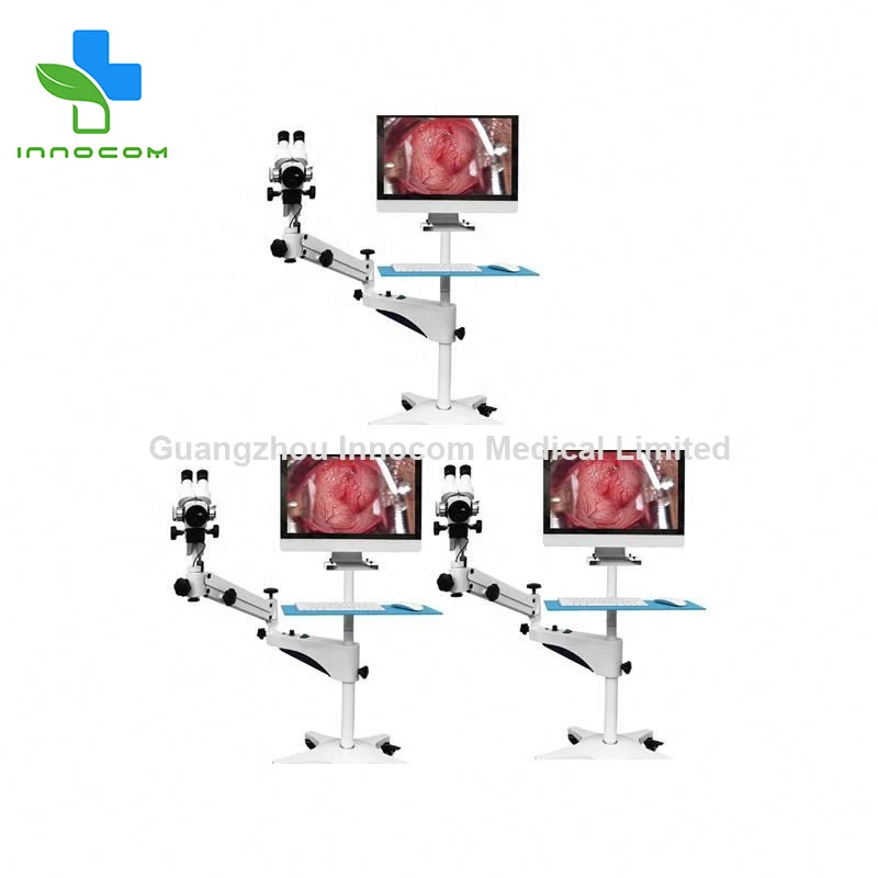 Well-sold china medical equipment video colposcope digital colposcope for gynecology infrared colposcope low cost
