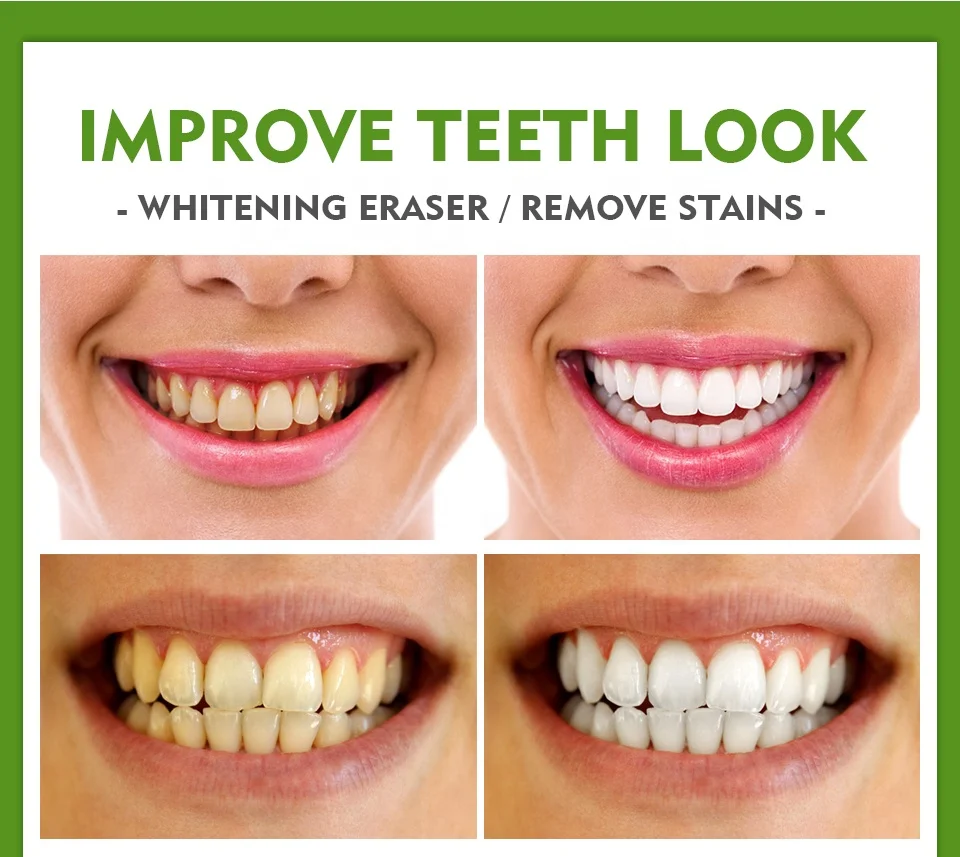 VIBRANT GLAMOUR Teeth Whitening Pen Cleaning Serum Remove Plaque Stains Protect Oral Hygiene Nursing