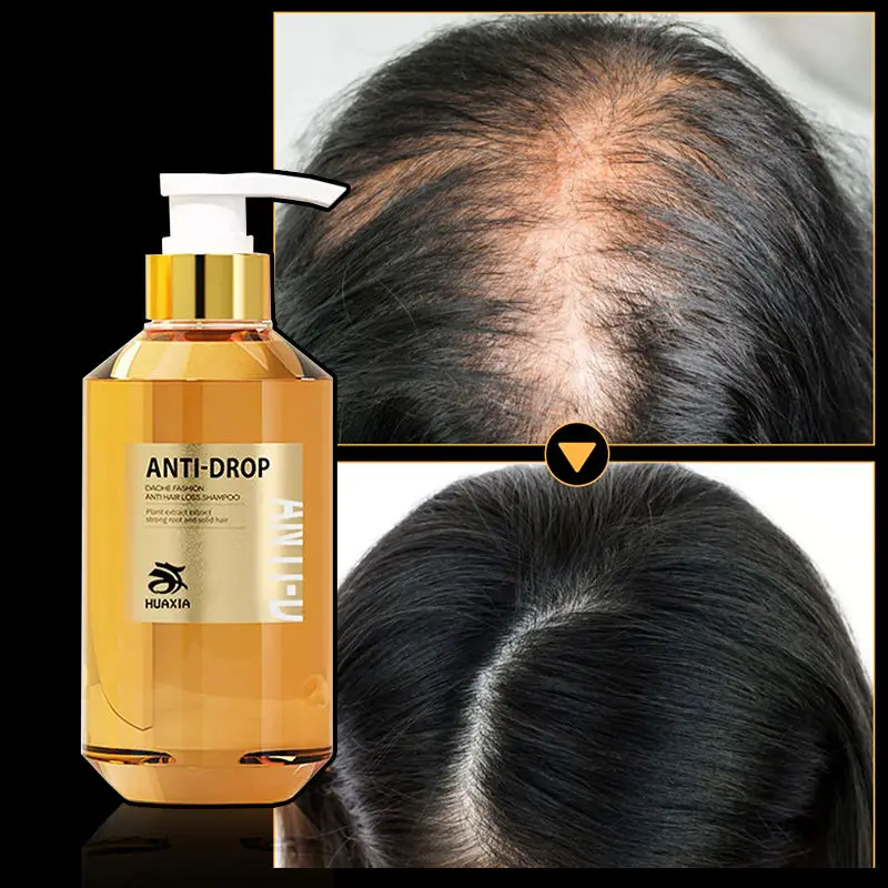 Private Label Anti-Hair Loss Shampoo Promote Hair Growth Plant Extract Herbal Hair Anti-Dandruff Shampoo