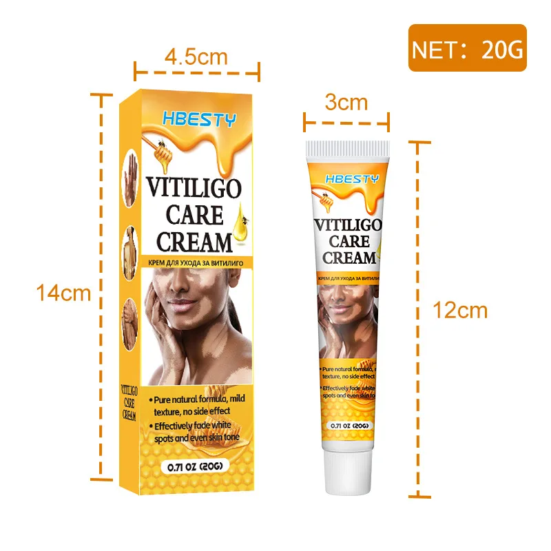 HBESTY Effectively Remove Vitiligo Ointment Remove Ringworm White Spot and Vitiligo Skin Care Product