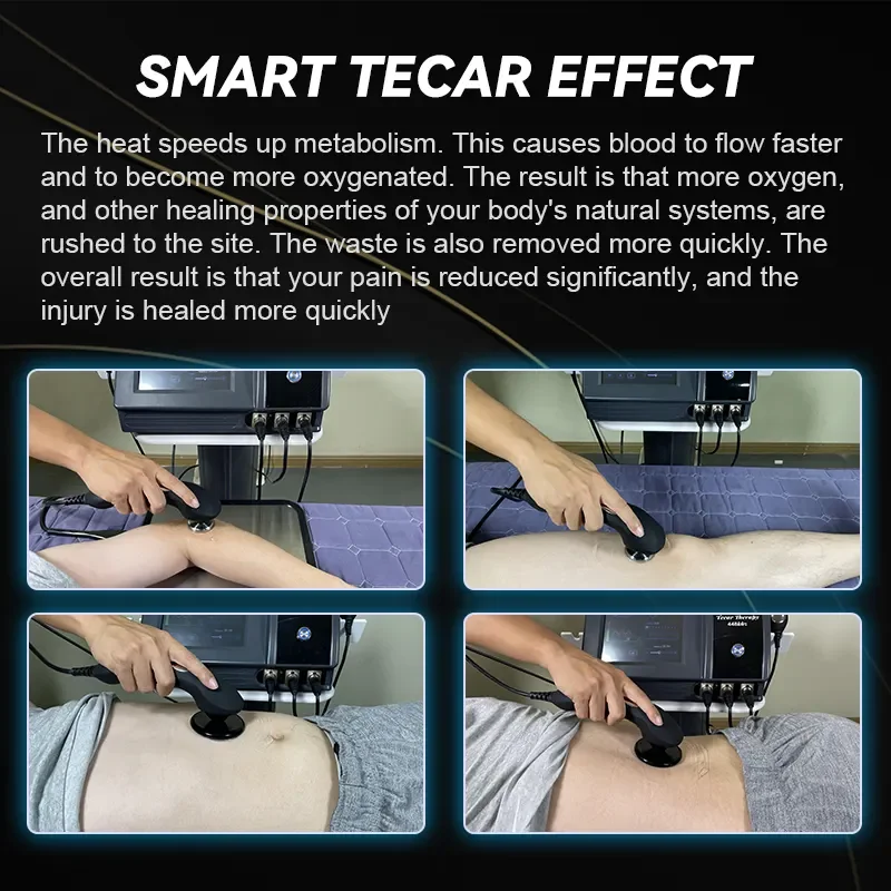 Портативный 448 кГц tecar fisioterapi гипоксия терапией физиотерапевтический аппарат для обезболивания