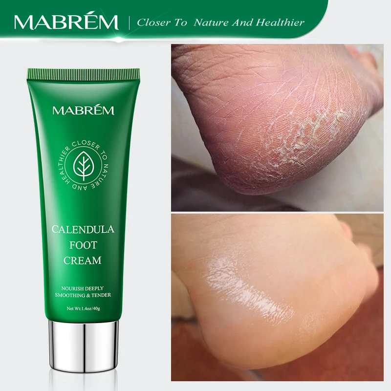 Foot Treatment Cream Whitening Anti-cracking Moisturizing Foot Care Exfoliating Scrub Anti-dry Repair Foot Cream Calendula Olive