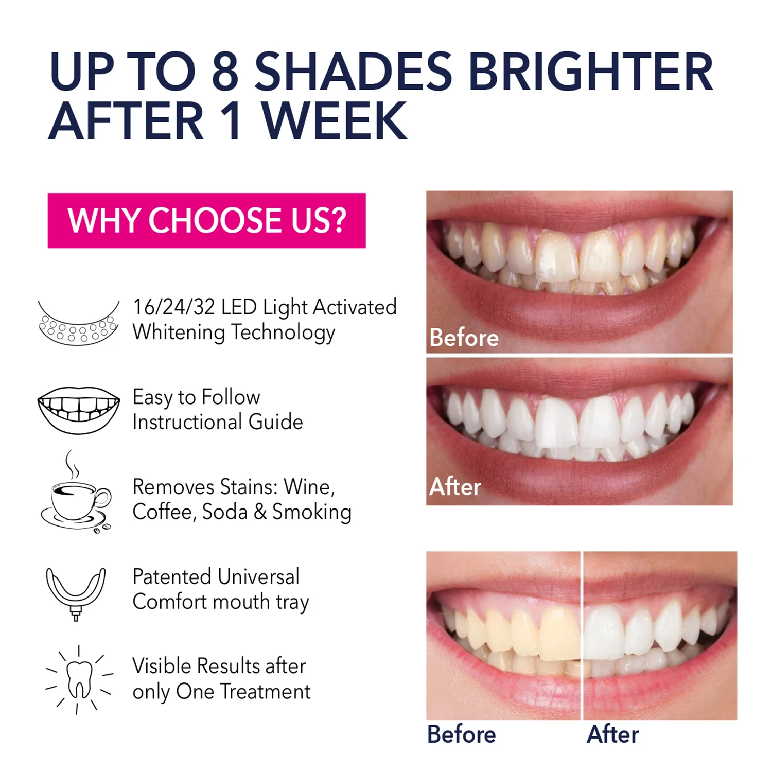 Private Logo Non Peroxide Teeth Whitening Pens SmartPhone Powered 16 or 24 LEDs Light CE Teeth Whitening Kit