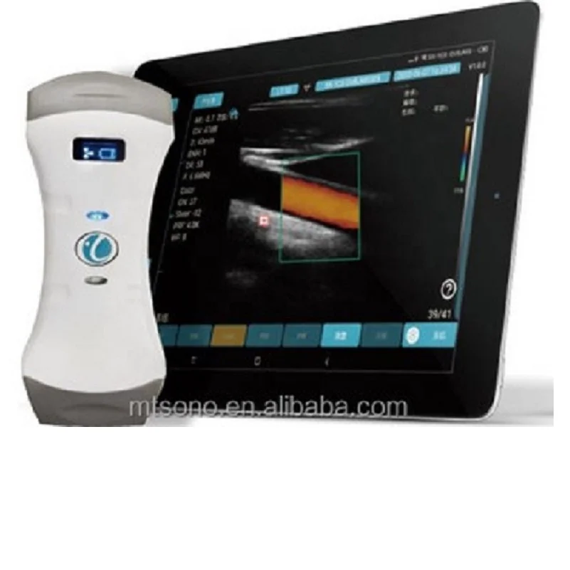 Double Head Wireless Ultrasound Probe Portable  Doppler Ultrasound Convex and Linear Wireless Ultrasound Scanner