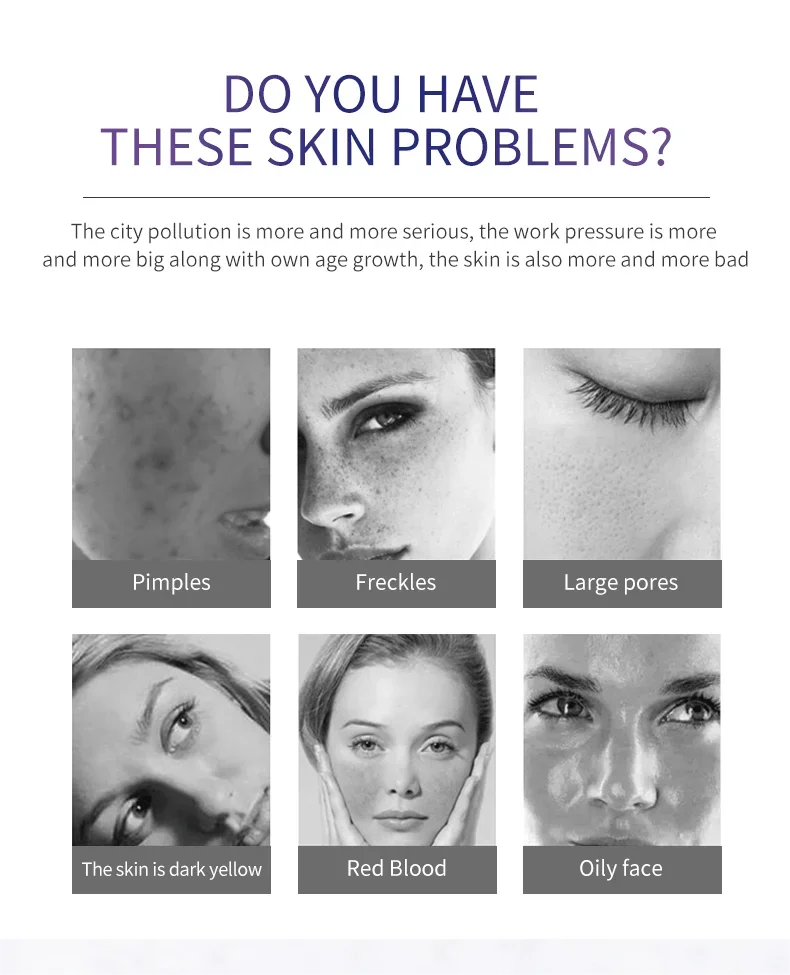 Effective 7 In 1 Cold And Hot Nano Water PDT Face SPA Red Light PDT Photon Rejuvenation Photon Mask Beauty Instrument