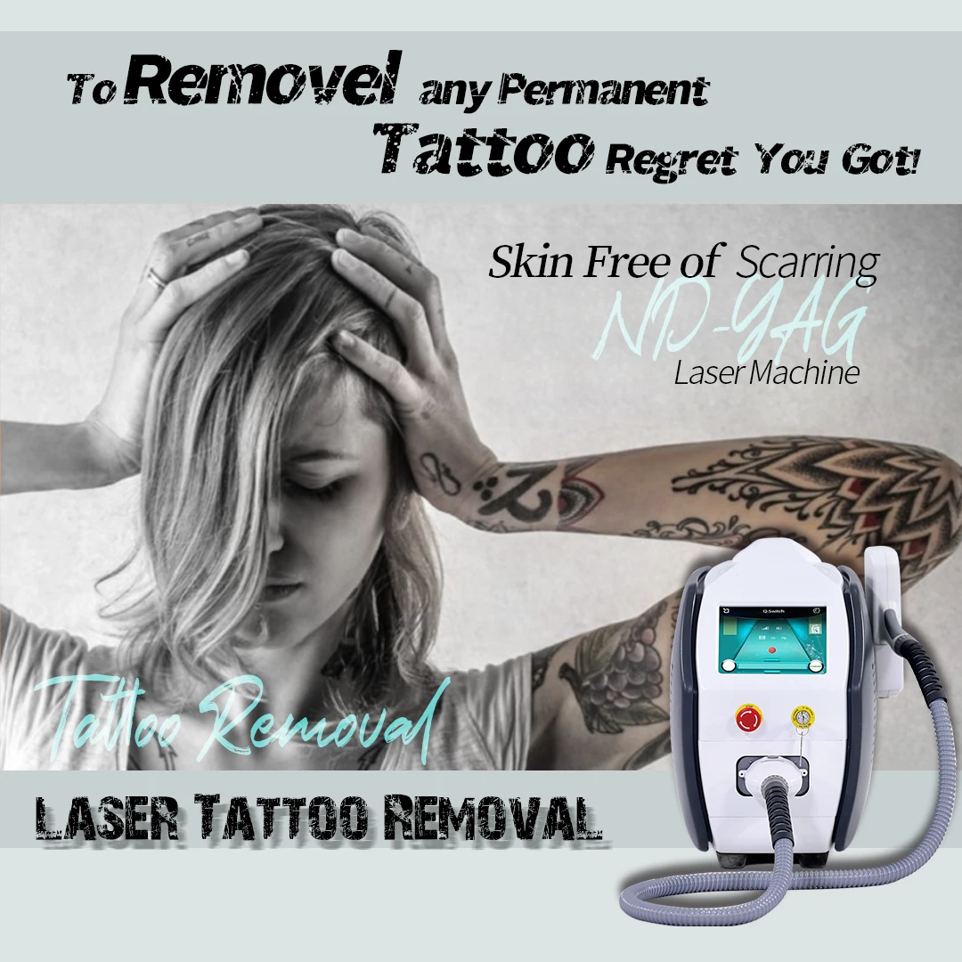 KES Factory Price 532 1064Nm Nd Yag Laser Tattoo Removal Machine Nd Yag Tattoo Removal Laser for Sale