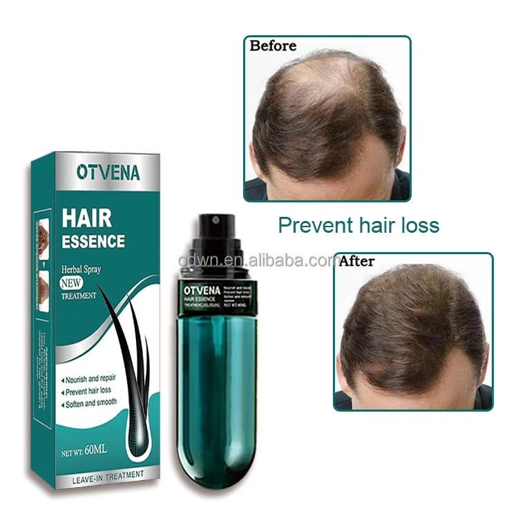 100% Natural Women Hair Treatment Oils 60ml Bulk Wholesale Best Effective for Hair Growth