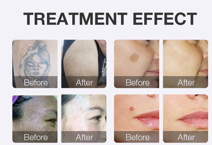 skincooler beforeafter.jpg