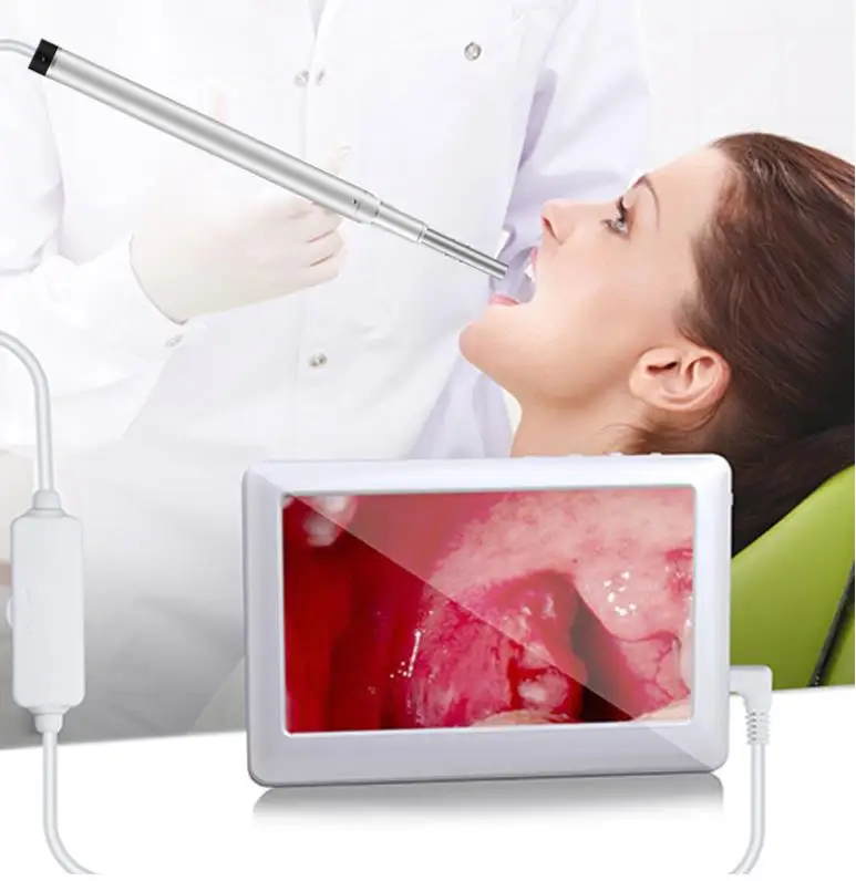 Отоскоп для экрана 3,9 мм, ушной эндоскоп с 4,3 дюймовым ЖК-дисплеем, Лидер продаж amazon aliexpress