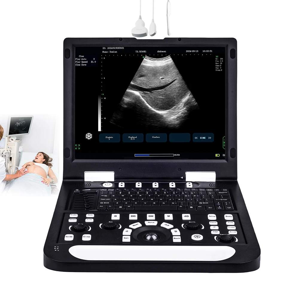 RS-N60 Medical Ultrasonic Instruments Portatil 2d Electric Black And White Ultrasonic Machine For Vet